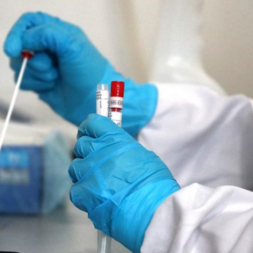 СИТУАЦІЯ З COVID-19 НА СНОВЩИНІ СТАНОМ НА 17 СІЧНЯ