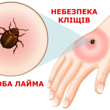Як уберегтись від хвороби Лайма