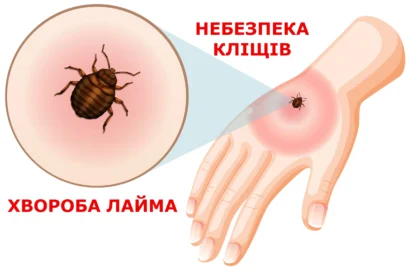 Як уберегтись від хвороби Лайма